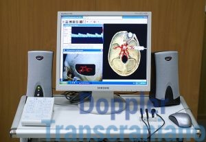 Indicações Neurológicas do Doppler Transcraniano