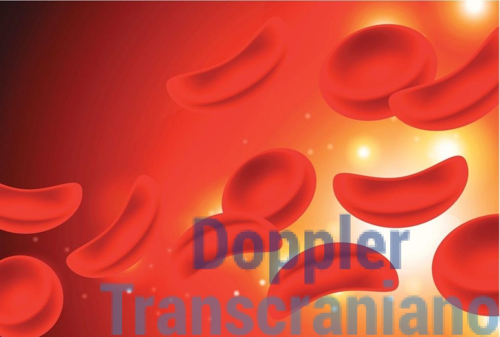 Anemia Falciforme - Sintomas, Diagnóstico e Tratamento