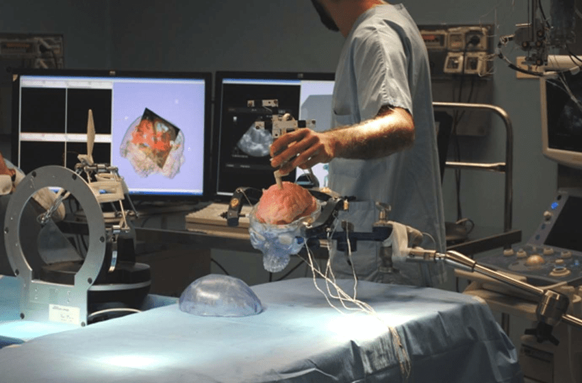 Ultrassom do Cérebro - Ultra-som de Cabeça Avaliação Neuropsicológica